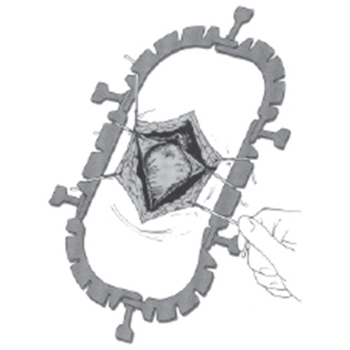 Jorgensen Labs Lone Star Retractor